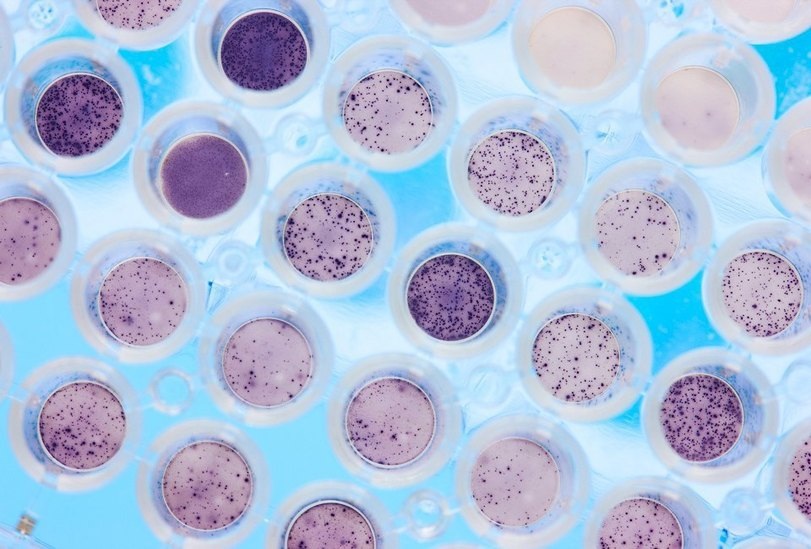 Видел я мамашек которые отказываются вести своих дитяток на прививки. Потом дитятко чихнет - сразу бежит к врачу. Врач спрашивает - какие прививки делали?
Мамочка - никакие, мы врачам не доверяем.
Dat logic!