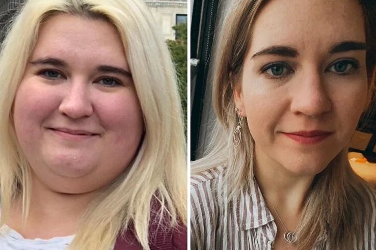     На 50, 70 и даже 100 кг: 10 убедительных примеров похудения обычных людей — фото до и после