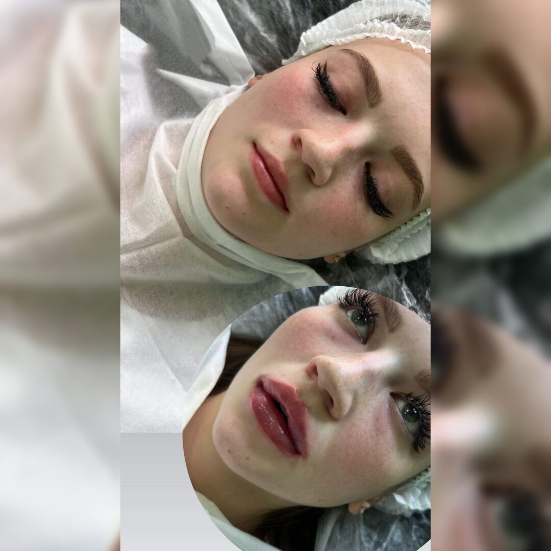 Ловим самые выгодные сеты  к Новому Году: 1. Чистка+пилинг+лазерная эпиляция подмышечных впадин 4️⃣.0️⃣0️⃣0️⃣₽2. Чистка+пилинг+глубокое увлажнение губ 6️⃣.0️⃣0️⃣0️⃣₽3. Биоревитализация лицо +шея+глубокое увлажнение губ для молодой кожи 1️⃣0️⃣.5️⃣0️⃣0️⃣₽для зрелой 1️⃣3️⃣.5️⃣0️⃣0️⃣₽4. Чистка+пилинг с эффектом биоревитализации+лазерная эпиляция зоны усиков 4️⃣.5️⃣0️⃣0️⃣₽5. Чистка+пилинг+контурная пластика губ 1️⃣3️⃣.5️⃣0️⃣0️⃣₽6. Липолитик любая зона+ лазерная эпиляция 3️⃣.5️⃣0️⃣0️⃣₽7. Чистка+пилинг+лазерная эпиляция зоны бикини 4️⃣.0️⃣0️⃣0️⃣р 👉🏻Запись в шапке профиля:@dr.nkina.yana📞 8963-835-57-07приём на красной линии в уютной студии, стаж более 3х лет 👩🏾‍⚕️