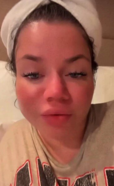     Певица показала свое изменившееся лицо скрин из видео: соцсети