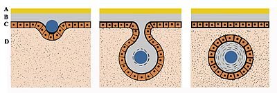 Погружение инородного тела в толщу мантии и формирование жемчужного мешка.