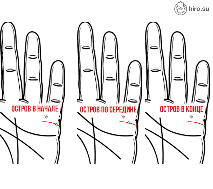 Остров на брачной линии. https://hiro.su/nikolay/linii/liniya-braka/