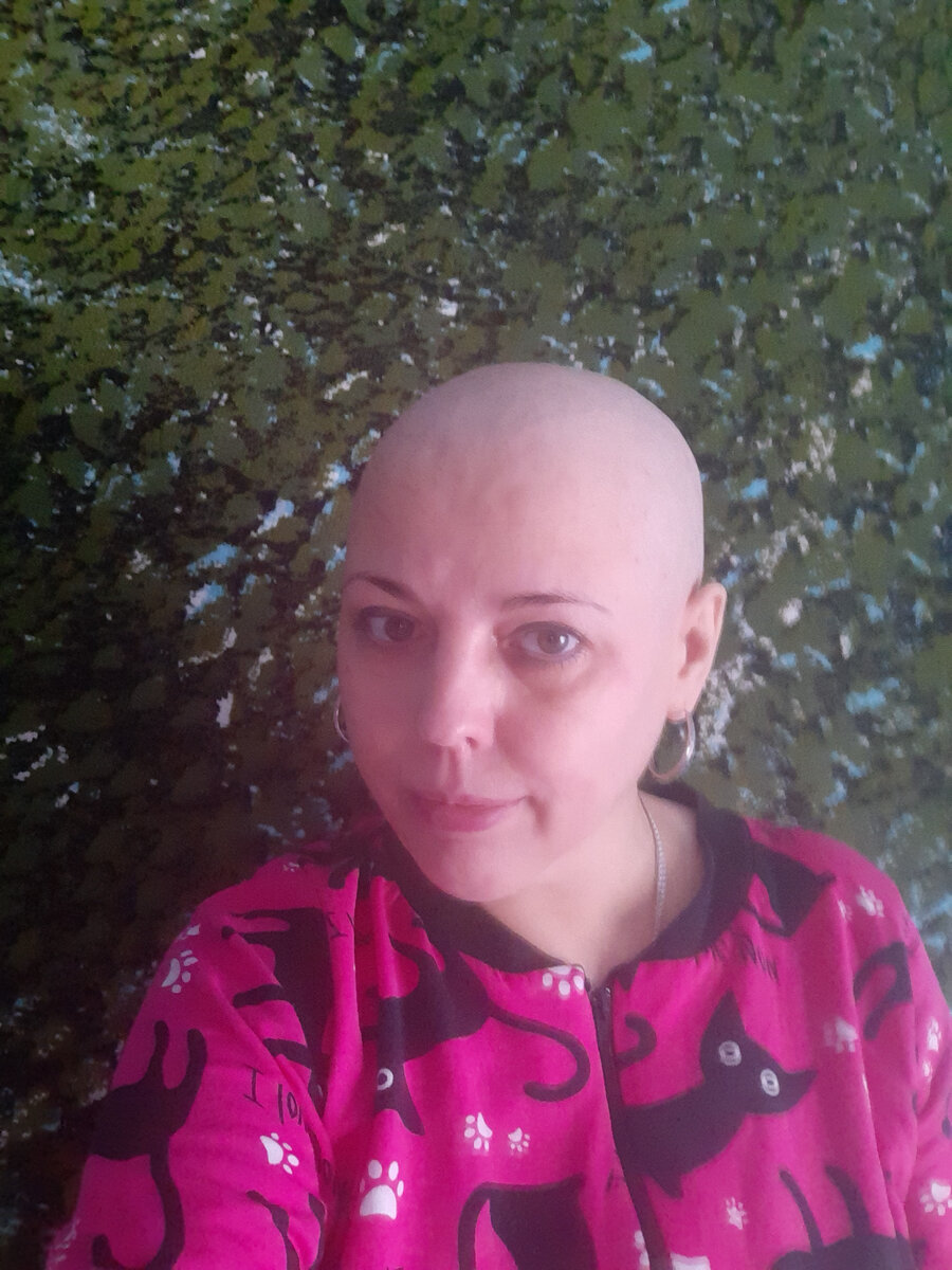 После второй химиотерапии. Март 2020 год