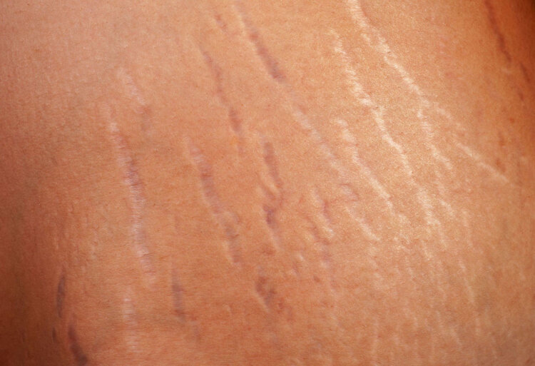 Фото из сети интернет