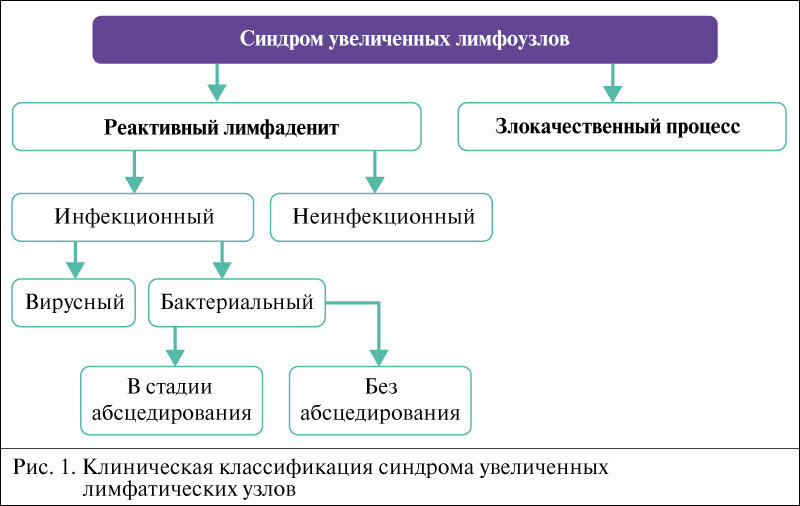 Лимфоузел инфекционный мононуклеоз. Воспаление лимфатических узлов. Увеличение лимфоузлов инфекция. Оимфоаденопатии классификация. Лимфаденит клинические симптомы.