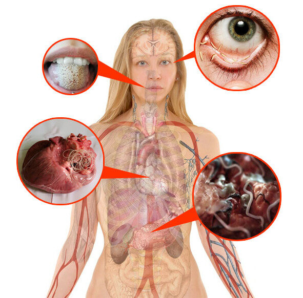 Фото с портала МедИнфо