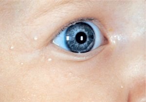 Наиболее часто пожелтение тела у ребенка возникает еще в роддоме до выписки домой.