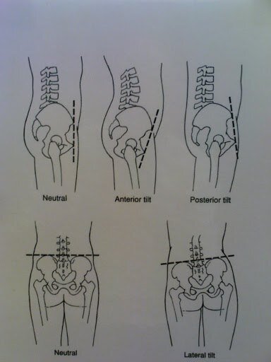 Выравнивание таза. Неправильное расположение таза. Искривление таза. Смещение таза. Положение таза.