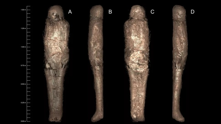 ИЛЛЮСТРАЦИЯ CHAU CHAK WING MUSEUM/MACQUARIE MEDICAL IMAGING/ SOWADA ET AL. (2021). 