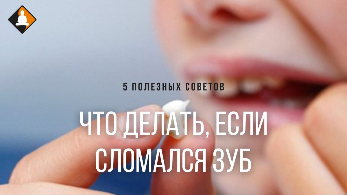 Сломался зуб: что делать взрослому в домашних условиях, как можно восстановить