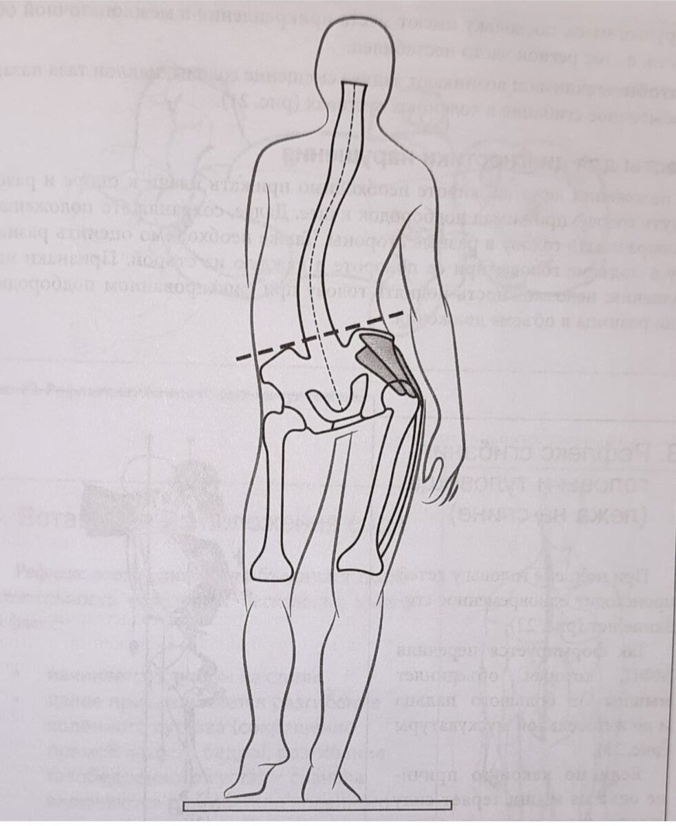 Пациент с болью в шее.

Специалист классической медицины начал бы бы исследование мышц и позвонков шейного отдела, назначил бы противовоспалитеотные, обезболивающие препараты, медикаментозные блокады.

Специалисту по прикладной кинезиологии важно определить не то место, которое болит, а то положение тела, которое провоцирует боль. Почему она возникает только тогда, когда пациент сидит? Что это означает? В положении сидя происходит нарушение работы мышц таза, что вызывает перегрузку шеи.

Кинезиолог, осмотрел пациента, найдёт причину - снижение тонуса одной из ягодицы мышц. Причиной является нестабильность таза.

Книга #ВасильеваЛФ
#прикладнаякинезиология
#кинезиологЕвпатория #НапрюшкинС