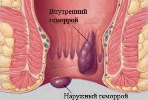 Продемонстрированы внутренние и наружные узлы.