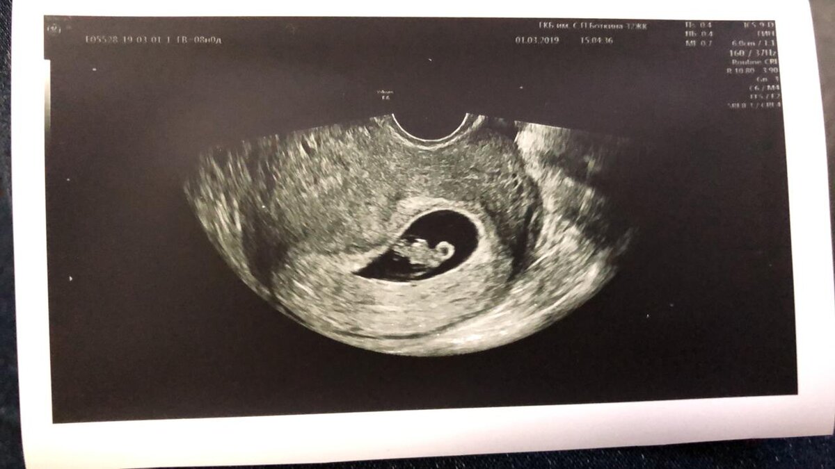 Фото, заряженное на беременность )