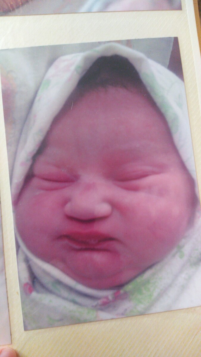 Здесь видно вмятинку на носике. Это её первый день жизни