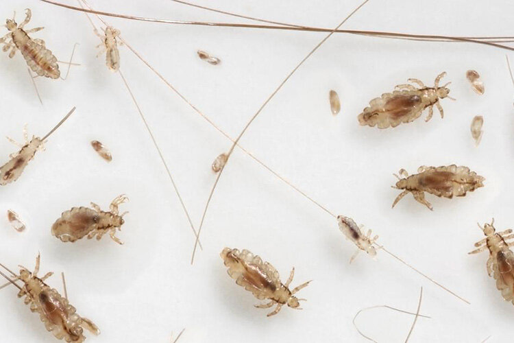 Бельевые вши