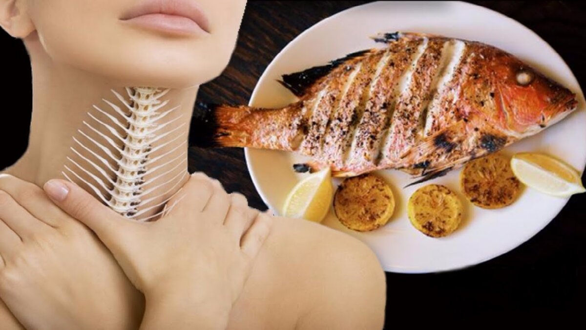 Застрявшая в горле рыбья кость это неприятно, но не смертельно, только без паники. Фото из открытых источников "Яндекс картинки"