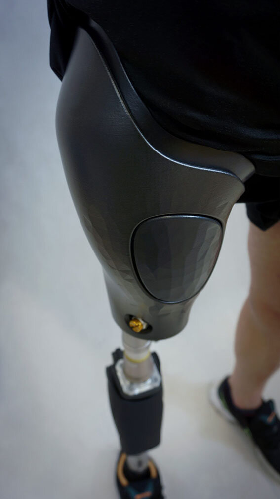 Внешний вид протеза после обработки методом PostPro3D