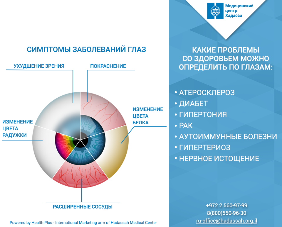 Какие болезни можно определить по глазам человека. Определение здоровья по глазам. Определить проблемы со здоровьем по глазам. Как проверить состояние здоровья по глазам.