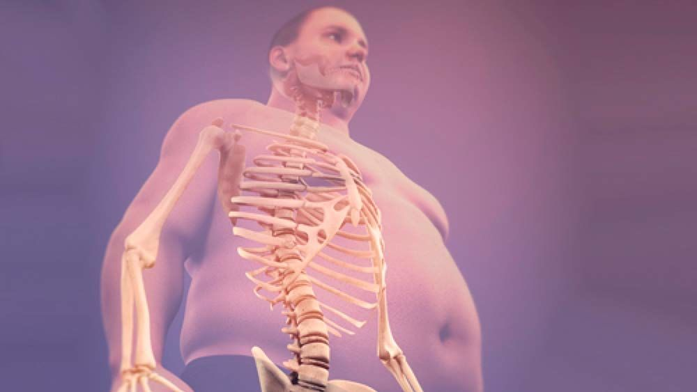 Полный скелет человека. Скелет Толстого человека. Скелет Толстого человека рентген. Толстый человек скелет.