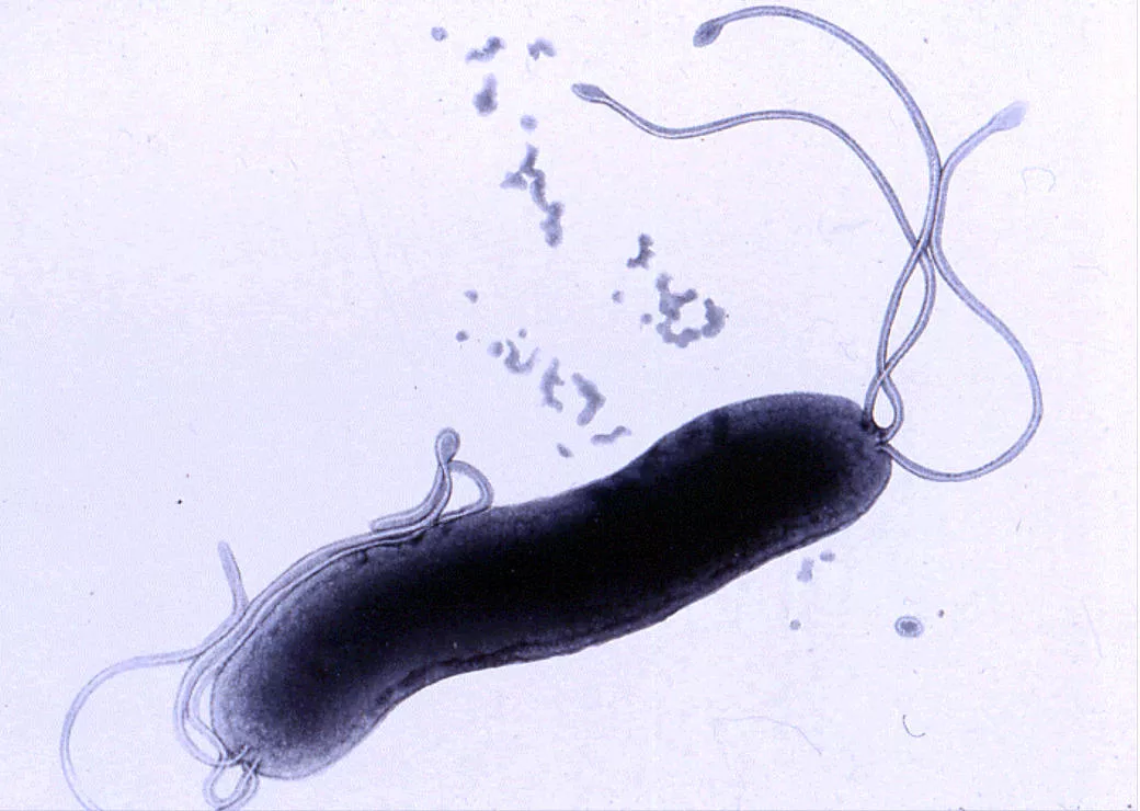 Helicobacter. Бактерия хеликобактер пилори микроскоп. Хеликобактер пилори под микроскопом в желудке. Helicobacter pylori микробиология. Строение бактерии хеликобактер пилори.