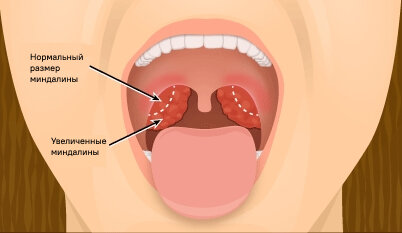 Источник: blog.talon.by