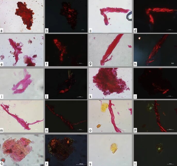 Археологические остатки наблюдали в проходящем и кросс-поляризованном свете с окрашиванием соединением PSR.
