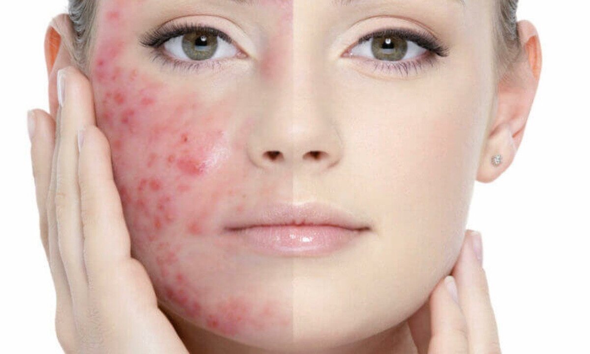 картинка из сети "Интернет"