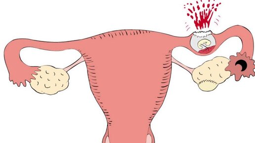 После овуляции болит низ живота. Может ли болеть низ живота при оплодотворении. Может ли болеть низ живота при оплодотворении. 16 день цикла болит низ живота. Может ли болеть низ живота при оплодотворении.