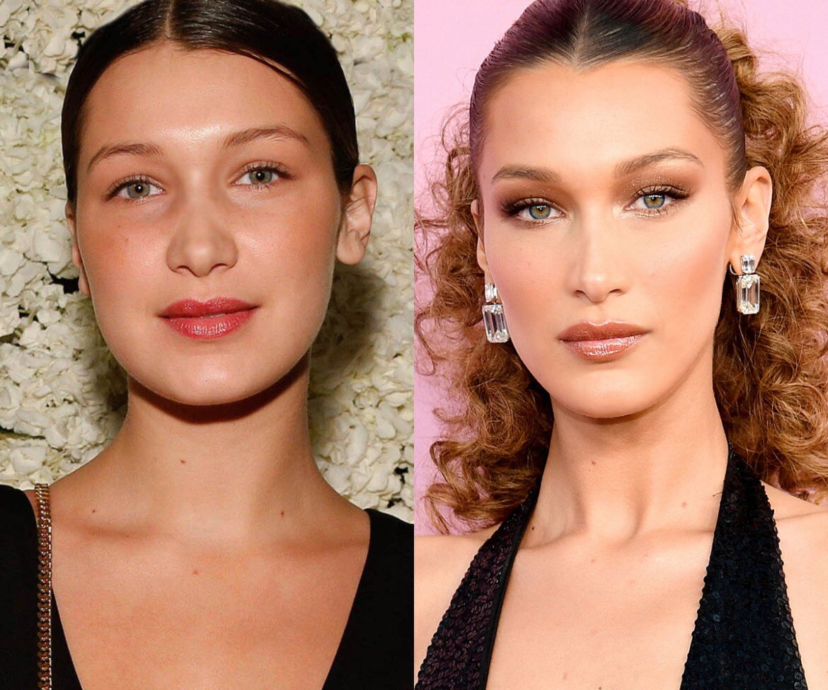 Лиц 23. Белла Хадид до пластики. Белла Хадид ринопластика. Bella Hadid до пластики. Белла Хадид до и после.