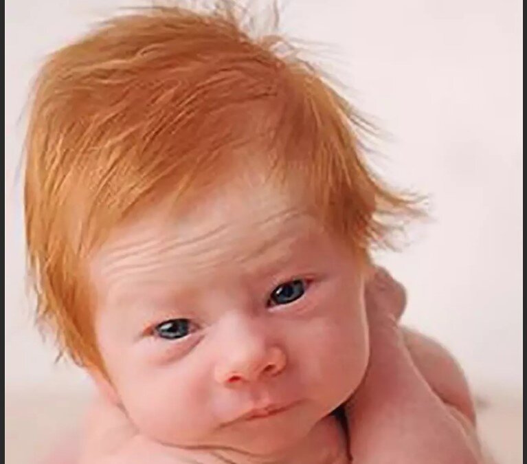 Родилась с рыжими волосами. Рыжий малыш. Рыжий новорожденный. Рыжий новорожденный ребенок. Рыжеволосые дети.