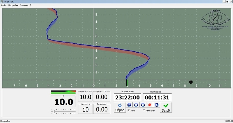Прибор ИПЭР-1К для выявления эмоциональной напряженности