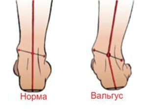 Источник: Яндекс. Картинки