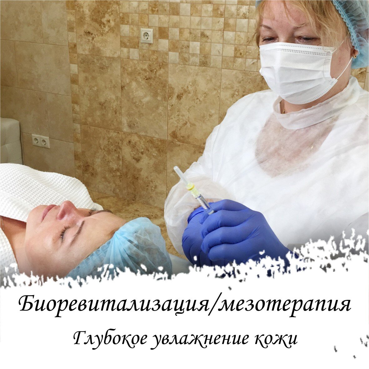 Инъекционные методы омоложения кожи (уколы красоты)