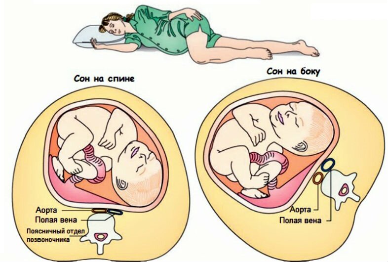 на каком боку лежать беременным. полезные позы для беременных. позы для сна при беременности 1 триместр. правильная поза для сна беременной. расположение ребенка в утробе.