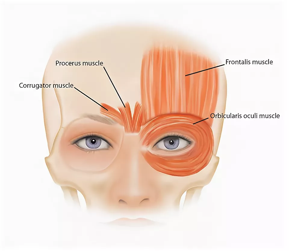 Мышца поднимающая бровь. Corrugator supercilii. Корругатор мышца. Мышцы над бровями. Мышца, сморщивающая бровь m. Corrugator supercilii.