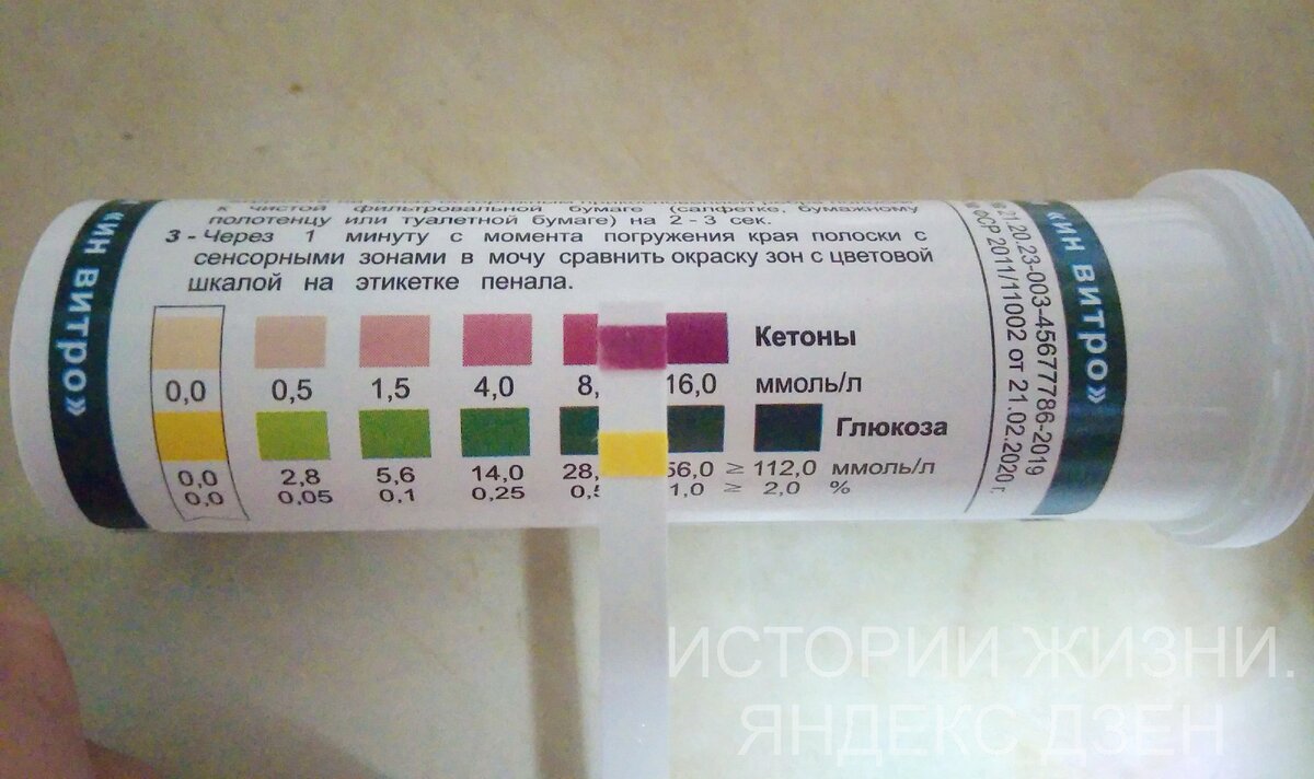 Кетоны в моче у мужчины. Ацетоновые полоски Кетоглюк. Кетоглюк-1. Тест полоски кетоновые ацетон. Тест полоски Кетоглюк.