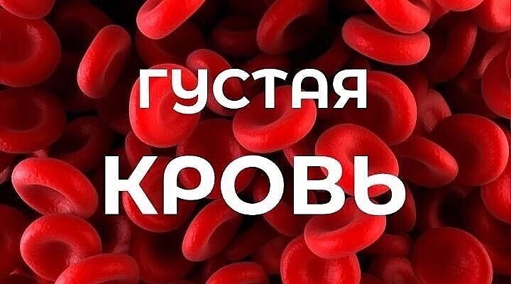 Густая кровь? 🤔 
⠀⠀ 
Густая кровь приводит к замедленному кровотоку в организме, что в свою очередь способствует кислородному голоданию внутренних органов и возможному образованию тромбов, гипертонии, затем последствия: инфаркт и инсульт. 
⠀ 
Безусловно, густую кровь необходимо разжижать, и восстанавливать ресурсы организма. 
⠀ 
Как это сделать? Ниже приведем несколько советов, способствующих лучшей циркуляции крови.👌🏻 
⠀ 
✅Для взрослого человека важно выпивать 2-2,5 литра обычной воды в день, и сюда не входят чаи или кофе. 
⠀ 
✅Из продуктов кровь разжижают чеснок и лук, свекла и томаты, лимоны и разнообразные ягоды. Из масел желательно отдавать предпочтения оливковому и льняному. 
⠀ 
✅А вот от продуктов, загущающих кровь лучше отказаться, например, это большое количество соли и соленостей в рационе. Это копчености, колбасы и хлебобулочные изделия (более полный список можно найти в интернете). 
⠀ 
✅Желательно полностью отказаться от курения и алкогольных напитков. 
⠀ 
✅Не забывайте, что некоторые лекарства способствуют загущению крови, например, это мочегонные, гормональные и противозачаточные препараты. 
⠀ 
✅Старайтесь больше гулять и вести активный образ жизни. 
⠀ 
✅Для разжижения крови отлично подойдет хиджама. Капиллярное кровопускание способствует расширению кровеносных сосудов, что в свою очередь разжижает кровь и нормализует кровоток в организме.