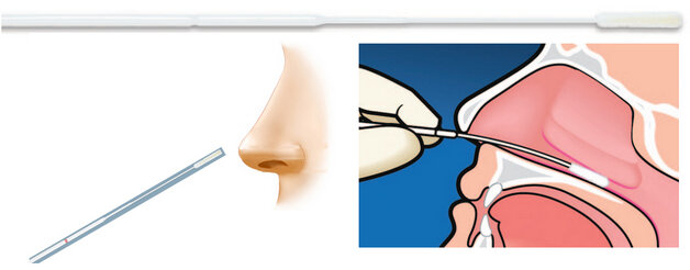 Мазок из носоглотки