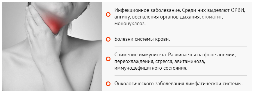 Воспалился лимфоузел на шее больно глотать. Лимфоузлы воспаление психосоматика. Боль в горле воспаление лимфоузлов. Шейные лимфоузлы психосоматика. Болит горло и болят лимфоузлы на шее.