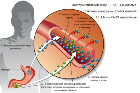 Главная цель лечения при сахарном диабете — достижение и поддержание уровня сахара в крови в значениях, указанных на фото.