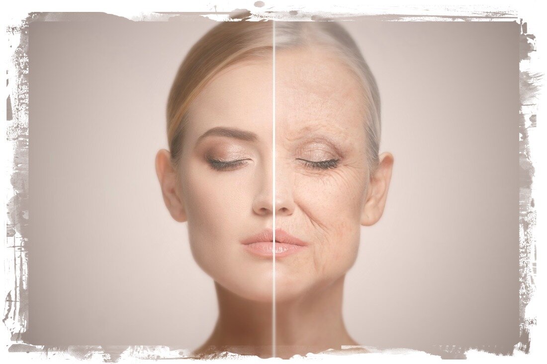 Что делать чтобы предотвратить образование морщин?