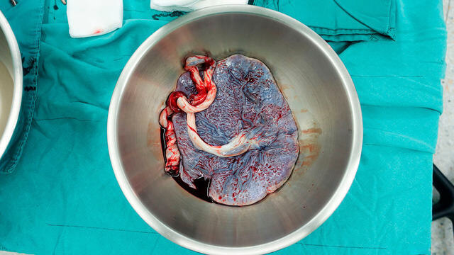 Плацента. Фото из интернета