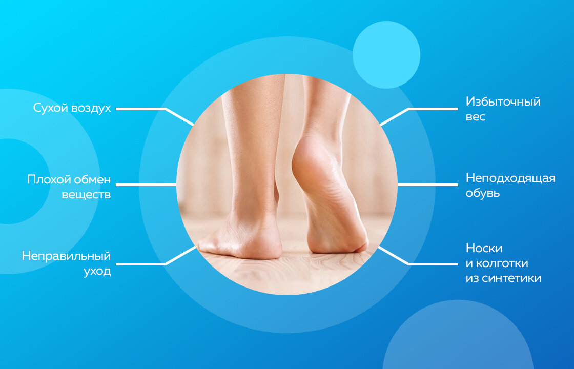 Есть 6 основных причин шелушения кожи на пятках.