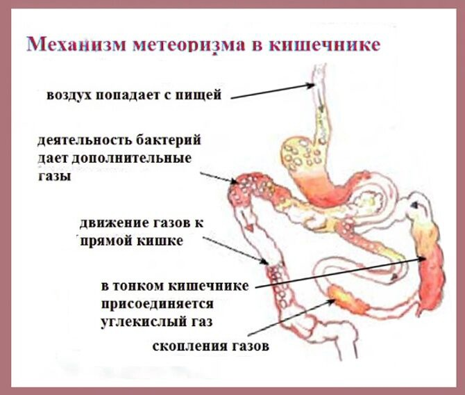 Вздутие живота. Что делать?