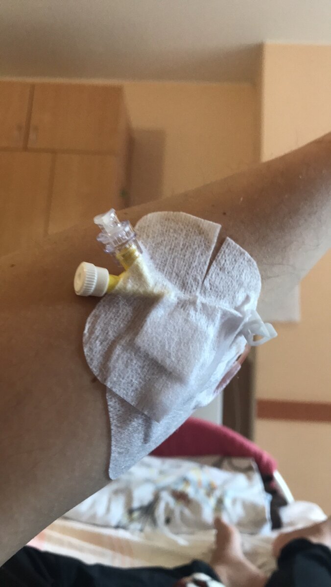 Канюля все тоньше и процедуры дольше.