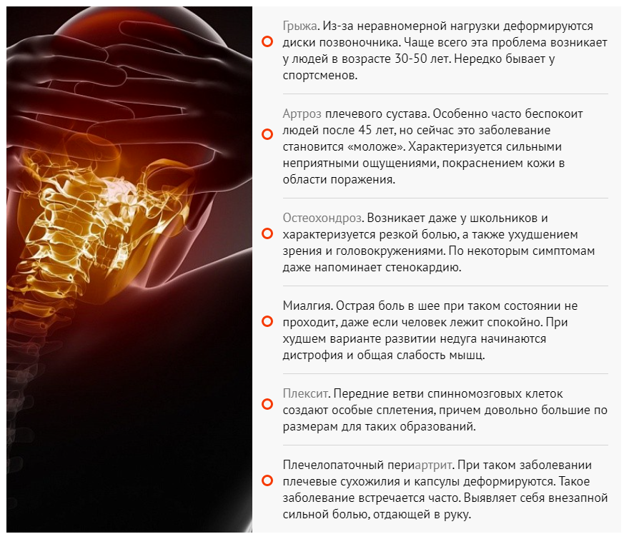 Миалгия что это лечение у женщин. Почему у человека длинная шея. Багровая шея причины возникновения. Проблема длиной шеи в организме. Почему шея тяжелая.