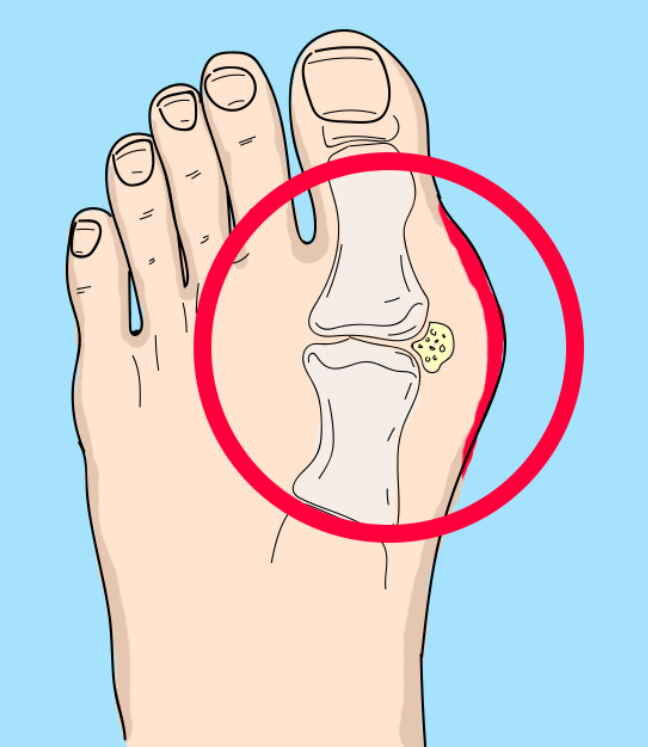 Фото: vseglisty.ru