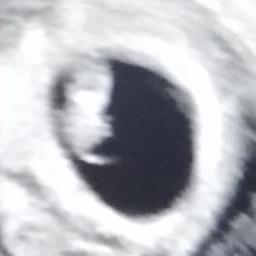 Первое фото)