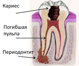 Боль в челюсти – симптомы, причины, лечение