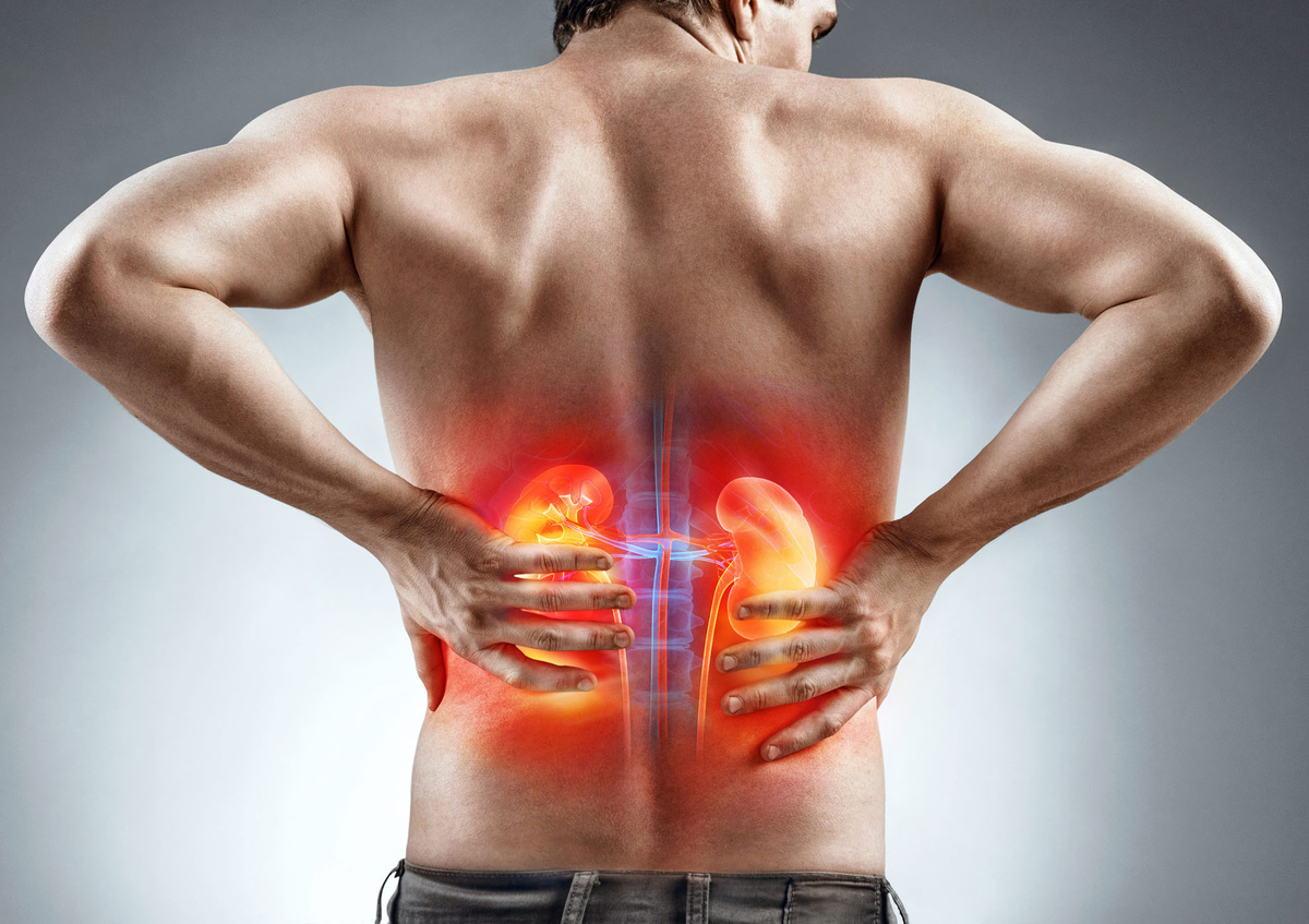 Где почки. Болит почка после операции. Болит почка после операции. У человека болят почки фото. Опущение почки операция.
